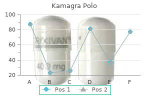 cheap 100mg kamagra polo fast delivery