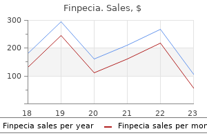 cheap 1 mg finpecia with amex