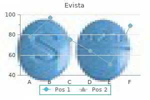 purchase 60mg evista mastercard