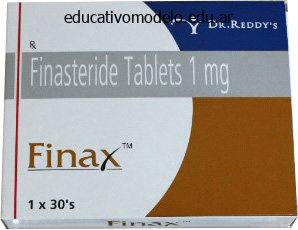 cheap finax 1 mg without a prescription