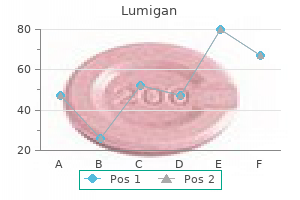 generic lumigan 3ml amex