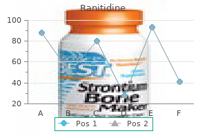 purchase 150mg ranitidine overnight delivery