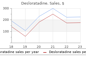 desloratadine 5 mg for sale