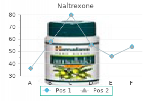 generic 50 mg naltrexone with mastercard