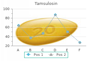 buy tamsulosin 0.2 mg free shipping