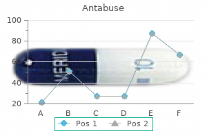 250 mg antabuse order with mastercard